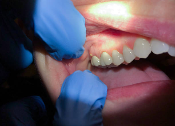 Best Pediatric Emergency Dentist in Kimberly, WI