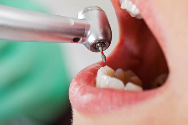 Best Pediatric Emergency Dentist in Kimberly, WI